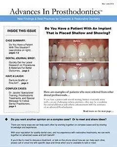 Advances in Prosthodontics Archives document 2018May-1