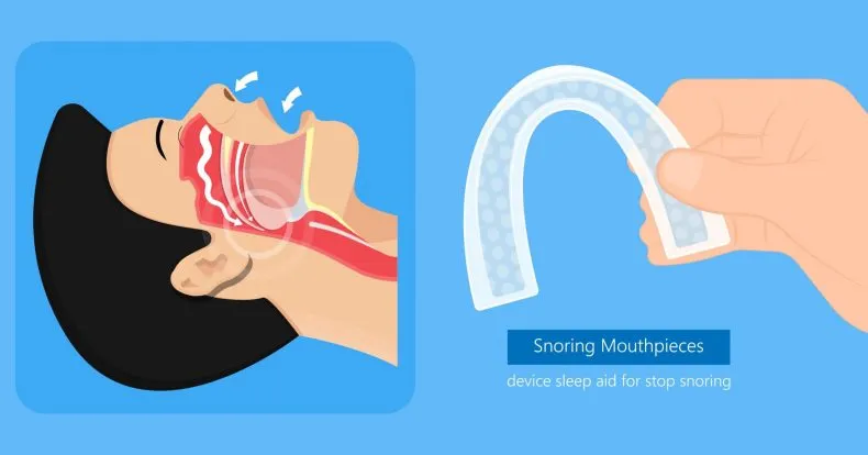 Illustration of a side-profile view of human airway anatomy next to a hand holding a clear, curved dental snoring mouthpiece. Text overlay at the bottom reads, 'Snoring Mouthpieces: device sleep aid for stop snoring'